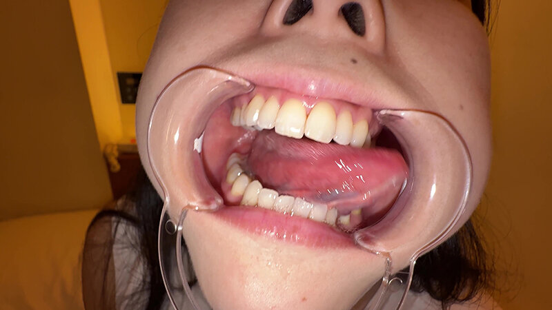 【個人撮影】横山夏希の喉チンコ触り&肉厚舌を開口器で観察 11枚目