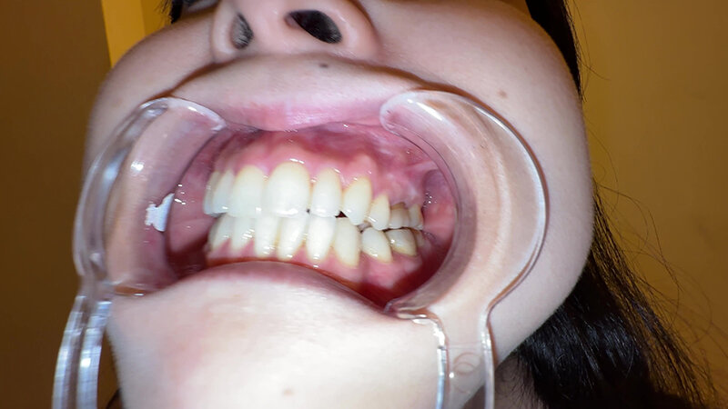 【個人撮影】横山夏希の喉チンコ触り&肉厚舌を開口器で観察 7枚目