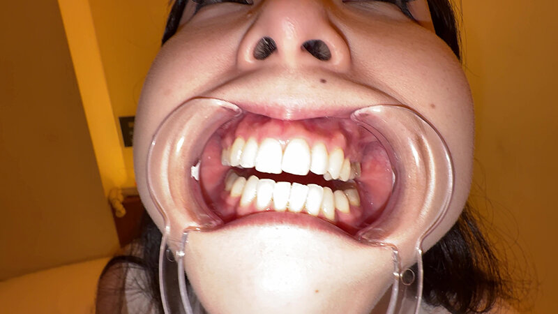 【個人撮影】横山夏希の喉チンコ触り&肉厚舌を開口器で観察 9枚目