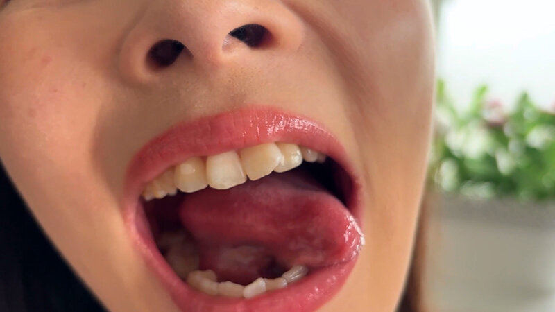 街角で声をかけて口内観察させてもらう ファーストフード店パート みおりさん 14枚目